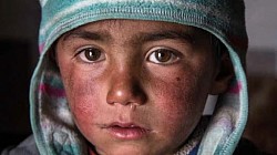 Save the Children